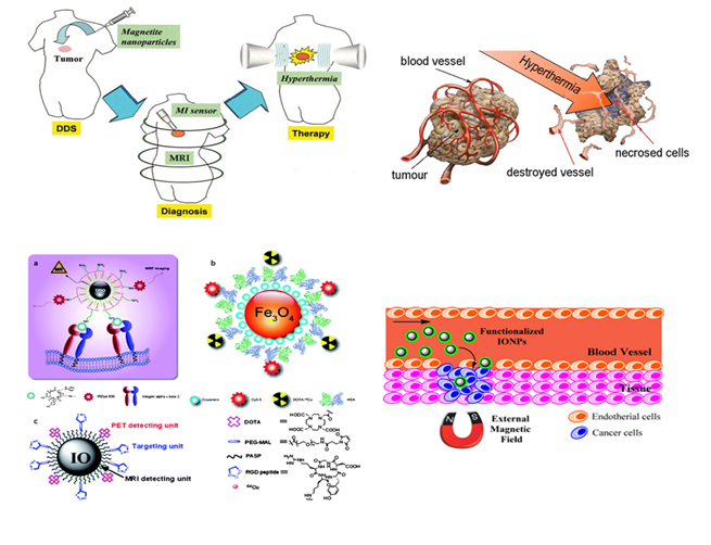 Figure 2. Normal to cancer.